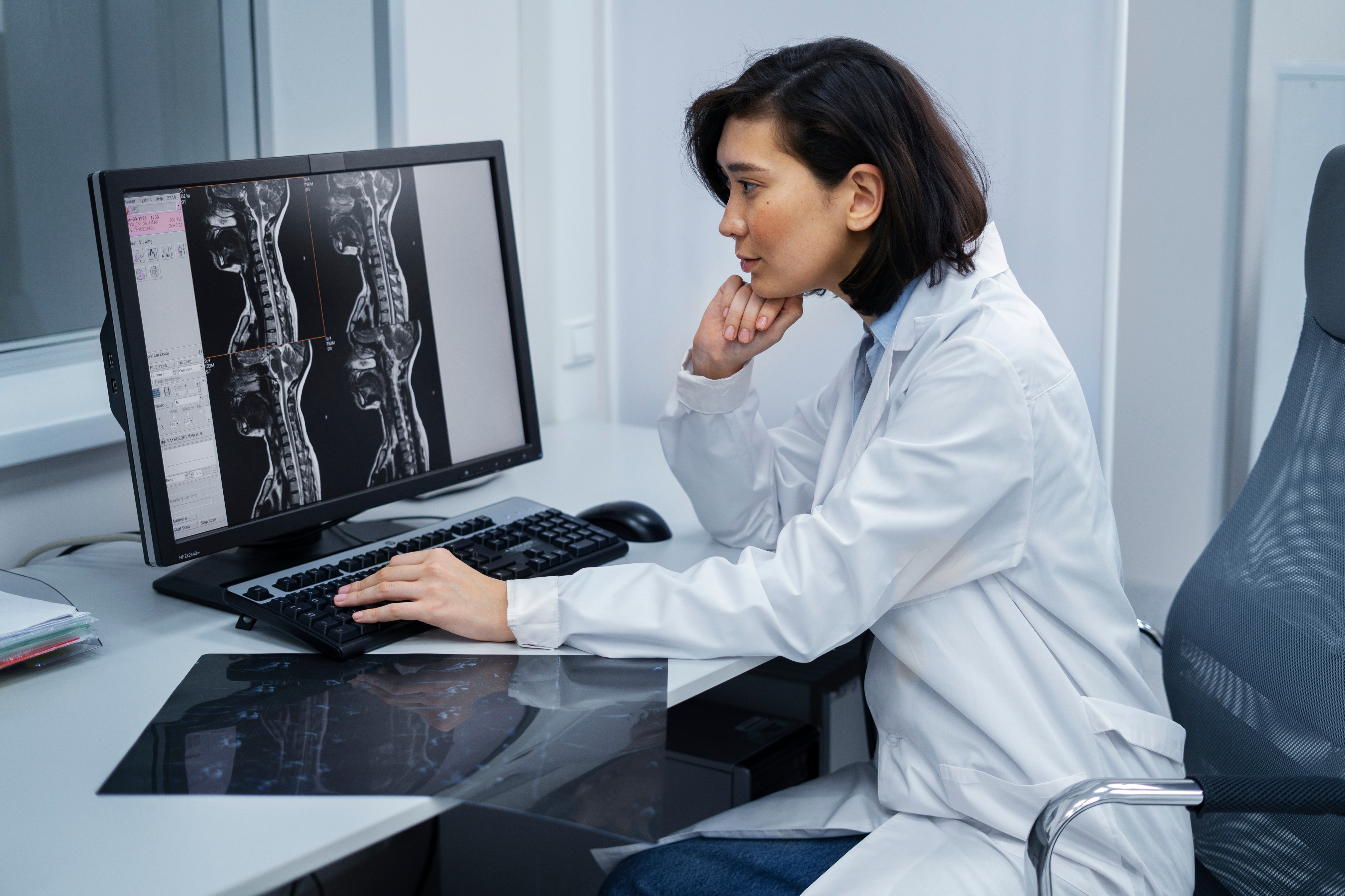 High-Resolution X-Ray Imaging at SB Diagnostics